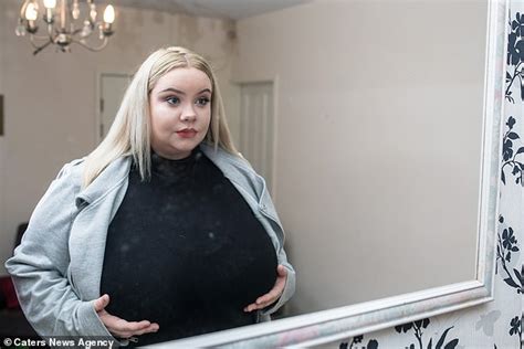 real life breast expansion|“My Breasts Grew 4 Sizes in 8 Months”: A Story of Gigantomastia